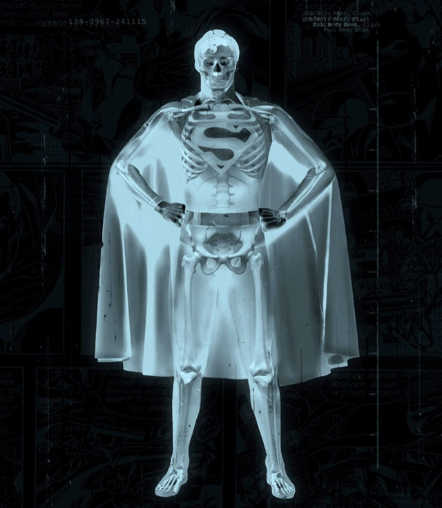 JJ Adams - 'Superman' - Framed Limited Edition Print